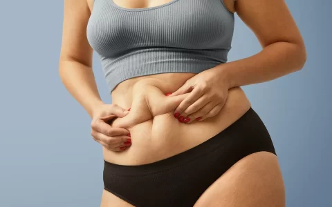 Lipoaspiração resolve flacidez?