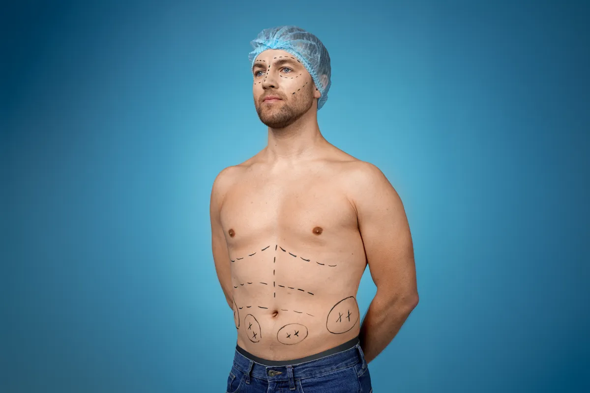 cirurgia plástica masculina